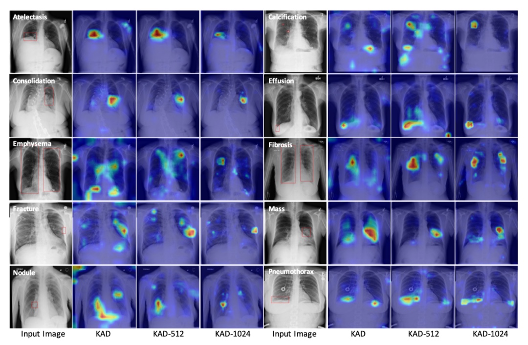 A Chest X-ray Disease Diagnosis Foundation Model, selected for a Nature Sub-Journal